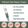 Crème réparatrice pour ongles, traitement fongique des ongles, traitement fongique. Facile à appliquer et à utiliser.