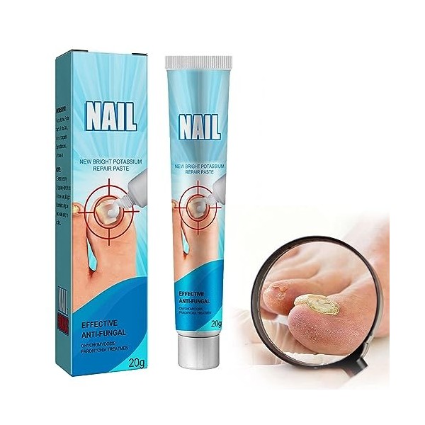 Emollient Ongle,Ongle Mycose, Nails Ongle et Stylo de Réparation D’ongle, Stylo de Soin D’onglePour Les Ongles Décolorés Épai