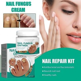 Traitement fongique des ongles pour ongles des orteils, traitement fongique pour ongles des orteils, crème réparatrice pour a