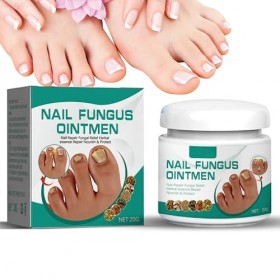 Traitement des ongles incarnés, huile allemande de paronychia, traitement des ongles dorteils, meilleure solution de réparat