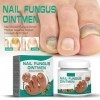 Traitement des ongles incarnés, huile allemande de paronychia, traitement des ongles dorteils, meilleure solution de réparat