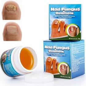 Traitement des ongles incarnés, huile allemande de paronychia, traitement des ongles dorteils, meilleure solution de réparat