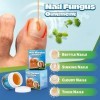 Traitement des ongles incarnés, huile allemande de paronychia, traitement des ongles dorteils, meilleure solution de réparat