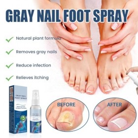 2Pcs Solution de Réparation des Ongles, Traitement Ongles, Soin des Ongles Huile de Soin des Ongles, Liquide de Renouvellemen