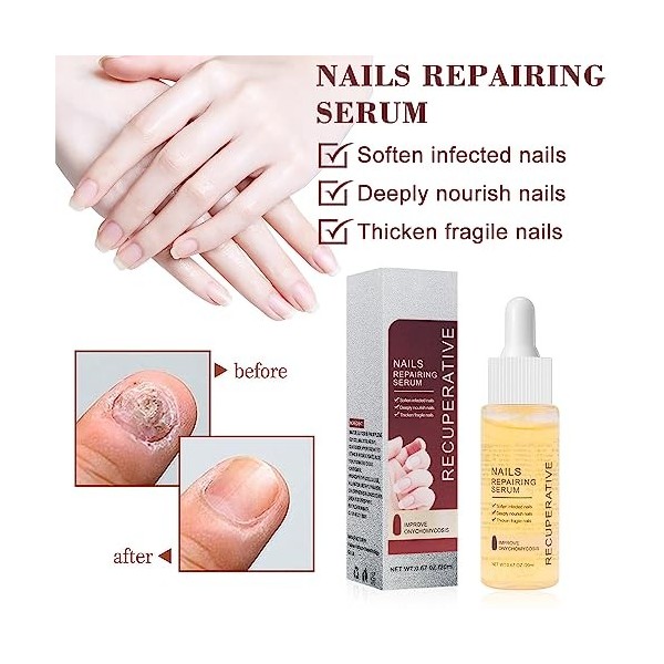 Renforcement des Ongles 7 jours, Sérum de Croissance des Ongles, Essence de Réparation des Ongles,Pour Réparer les Cuticules 