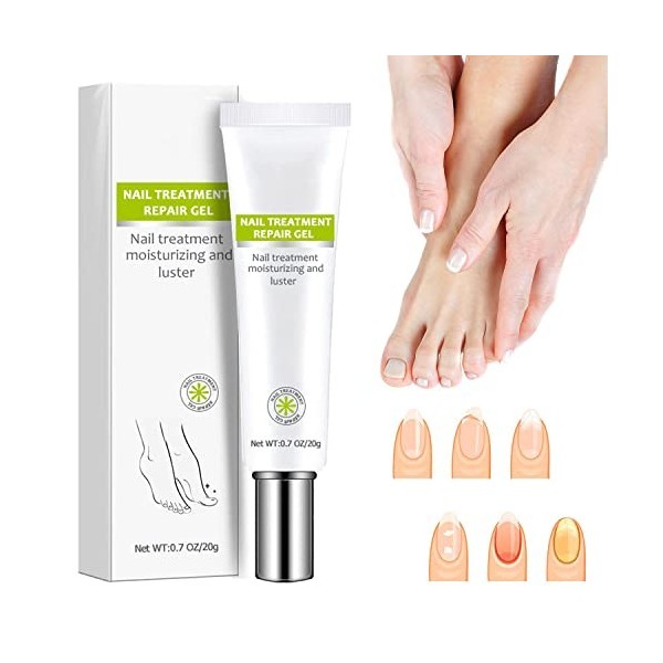 Réparation des ongles – Gel de réparation pour ongles et ongles des orteils – Crème de réparation pour ongles et ongles des o