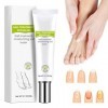 Réparation des ongles – Gel de réparation pour ongles et ongles des orteils – Crème de réparation pour ongles et ongles des o