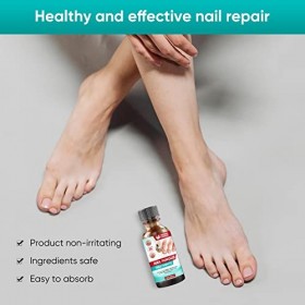 Chinoxia NailFglBLU1PM001 Traitement des ongles fongiques extra fort pour ongles dorteils Kit de réparation avec lime et bro