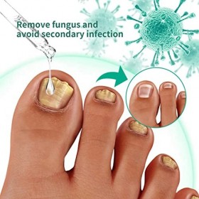 Huile de traitement antifongique pour ongles dorteils - Traitement anti-fongique - Traitement anti-fu_ngal - 30 ml