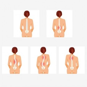 VEXIGO Appareil de Mesure médical pour scoliomètre de Poche pour Le Diagnostic de la scoliose du Dos Appareil Portable, Plage