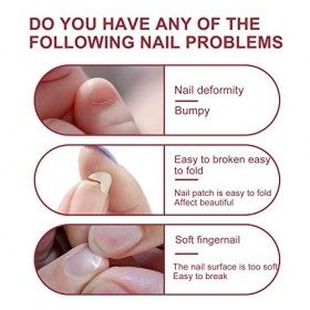 Kit Dextension Dongles en Fibre de Verre, ANGGREK 10PCS Fibre de Verre 20 Ml Kit de Réparation de Soins des Doigts en Gel D