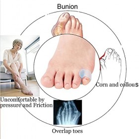 Yimanduo Lot de 10 attelles dorteils en gel pour petit orteil, redresseur dorteil marteau homme et femme, marche, course, c