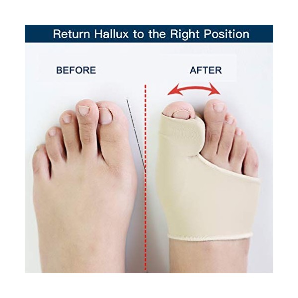 1 Paire de Orthèse Hallux Valgus avec Coussinet de Gel, Protecteur et Séparateur de Gros Orteil, Manchon Correcteur doignon 