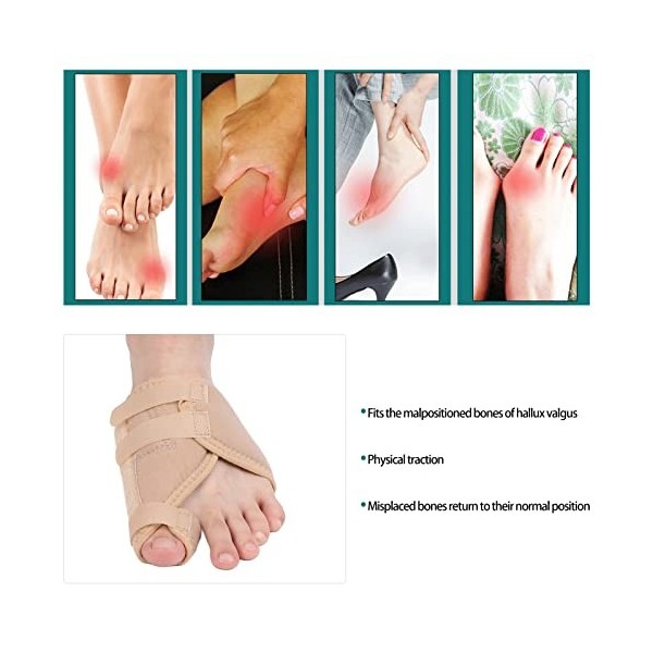 Hallux Valgus Correcteur, Attelle Orteil Correcteur dOignon Soulager les Douleurs de LHallux et Redresser Orteils, Lisseurs