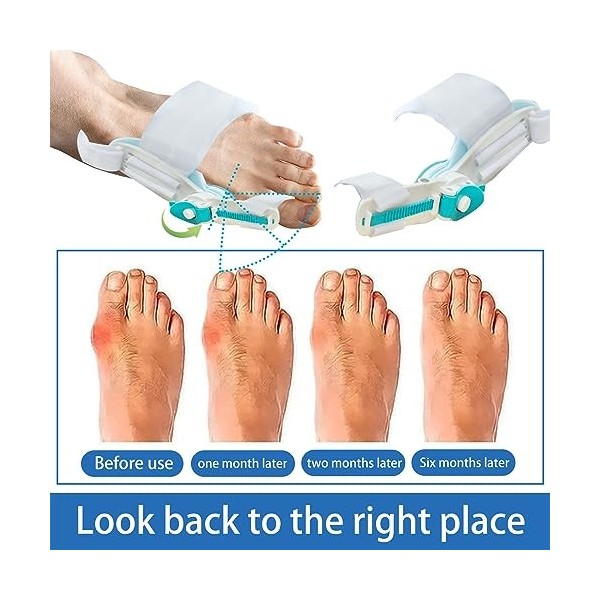 Leikurvo Correction dhallux valgus - Bleu - Attelle doignon - Attelle doignon réglable