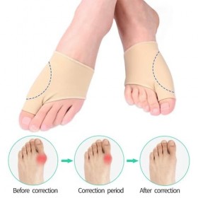 Correcteur Hallux Valgus,Hallux Valgus Correcteur DOrteils,Orthese Hallux Valgus,2 Paire Attelle Hallux Valgus,Gros Redresse