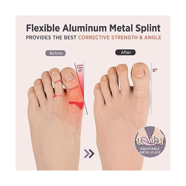 PEDIGOO Hallux Valgus Korrektor für Frauen, 2 Stück, rutschfester Bunion Zehenspreizer, Entlastung bei Hallux Valgus für Tag/