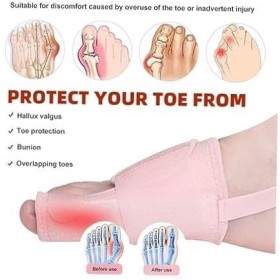 [New Version] Hallux Valgus Corrector - Toe Separator & Bunion Corrector Reduce Foot Friction Elastic Toe Corrector for Effec