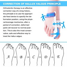 Kemei Paire de coussinets de correction avec attelle pour hallux valgus et oignon Soulagement de la douleur et correction pou