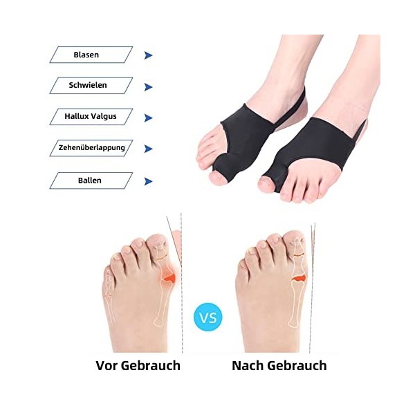 Eurtes Lot de 6 écarteurs dorteils hallux valgus - Avec protection des oignons - Correction de bunion - Bandage chaussettes 