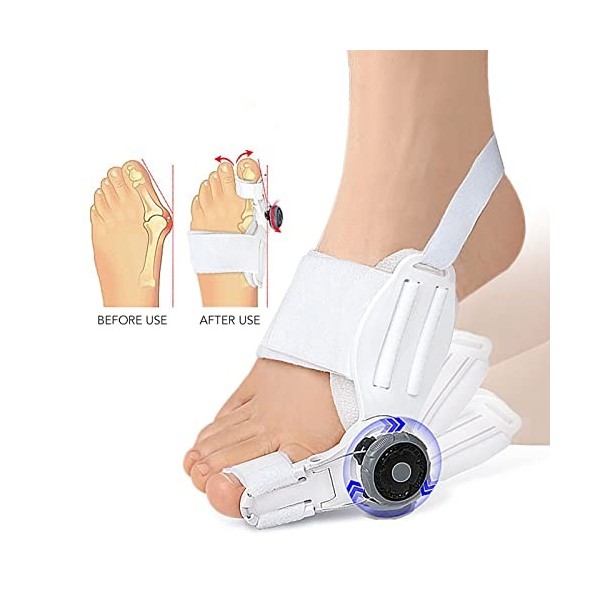 Correcteur Doignon Redresseur Orthopédique du Gros Orteil pour le Soulagement des Oignons Correcteur Hallux Valgus Ajustable