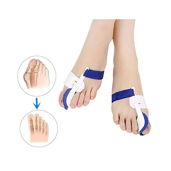 Kit correcteur doignon et de soulagement de la douleur dans lhallux valgus – Coussinets pour oignons, attelles, chaussons, 