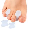 Sumiwish Séparateurs dorteils, Hallux Correcteur Orteils Correcteur pour Chevauchement Orteil, Oignon Soulagement des Douleu