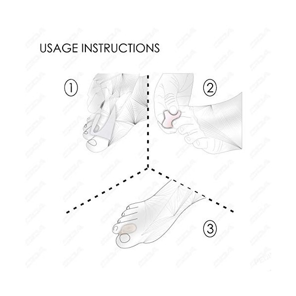 Lot de 4 séparateurs dorteils en silicone pour hallux valgus - Séparateurs dorteils en gel pour soulager la douleur des oig