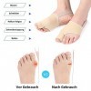 Eurtes Lot de 6 écarteurs dorteils hallux valgus - Avec protection des oignons - Correction de bunion - Bandage chaussettes 