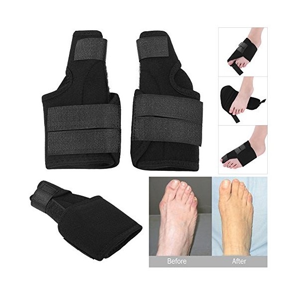 Semme Attelles correcteur doignons pour Gros Orteils Hallux Valgus Séparateur S 