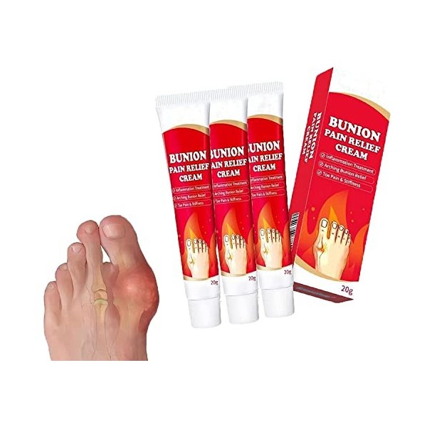 Arching Bunion Relief Cream, Joint Pain Cream Bunion Pain Relief Ointment, Joint Toe Pain Relief Stiffness Inflammation Treat