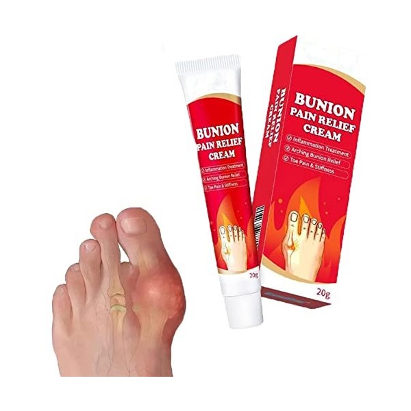 Arching Bunion Relief Cream, Joint Pain Cream Bunion Pain Relief Ointment, Joint Toe Pain Relief Stiffness Inflammation Treat