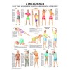 Stretching i mini-poster motif anatomie 34 x 24 cm et matériels médicaux ohne Laminierung