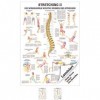 Stretching II Mini-Poster Anatomie 34x24 cm medizinische Lehrmittel