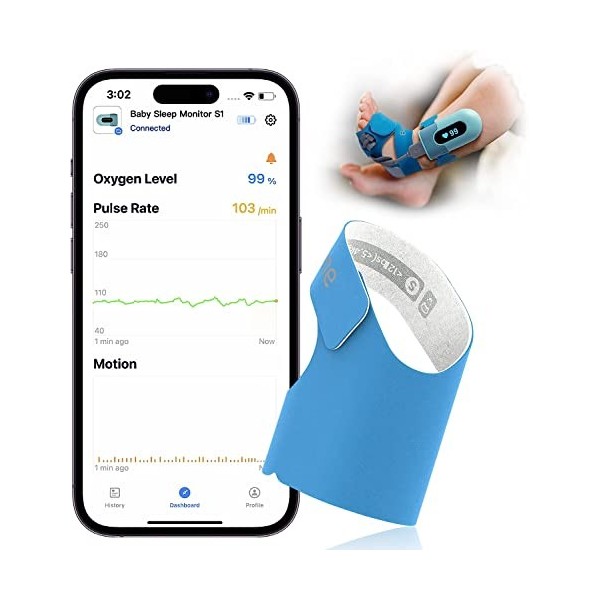 Oxymetre Bebe Sock, Suit Le Niveau doxygène, Fréquence Cardiaque et  Mouvements, Saturometre Bebe avec Bluetooth et APP, Oxym