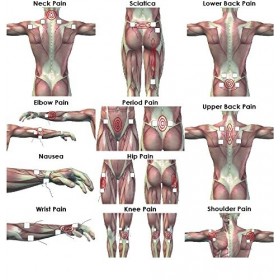 TensCare E-CM5050V 12&nbsp;électrodes 50&nbsp;x 50&nbsp;mm