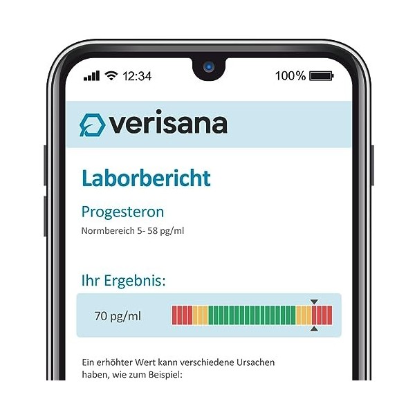 Test de progestérone | Test de salive hormonale | Examen chimique de laboratoire | Convient pour le syndrome prémenstruel et 