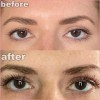 Daislashes Lash Serum - Lash Enhancers Boosting Growth Serum, Boost Serum For Longer Fuller Thicker Lashes