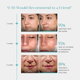 Sérum à l’Acide Hyaluronique ENCAPSULÉ - AH Multi-Moléculaire 4X PLUS EFFICACE - HYDRATATION 24H avec Libération Retardée HY-