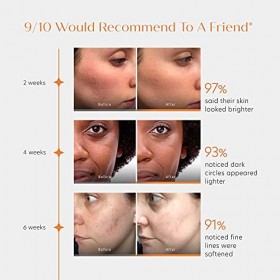 Sérum à la vitamine C ENCAPSULÉE - 4X + STABLE avec Encapsulage Liposomal - 2x + Efficace avec ANTIOXYDANTS SYNERGIQUES - Con