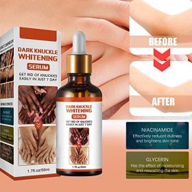 Sérum éclaircissant pour les Articulations,Acanthosis Nigricans Therapy Oil,Dessence Blanchissante pour Les Genoux,Sérum Bla