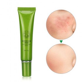 Crème Anti-Acné 15 G - Lotion Rafraîchissante Pour Le Visage - Pour Les Antiacnés, Éclaircir La Peau.