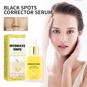 Dissolvant Taches Faciales,Essence de Peau du Visage Dissolvant de Taches,Dissolvant de Taches Noires,Huile Essentielle éclai