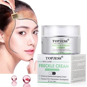 Crème Blanchissante, Creme Visage Anti Taches, Whitening Cream, Crème anti-taches de rousseur, Brightening Cream, Nourrissant