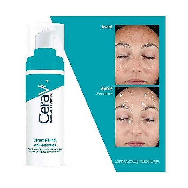 30 ML Cera-ve Serum Rétinol Anti Marques enrichi au Rétinol pour peaux à imperfections avec hyperpigmentation post inflammato