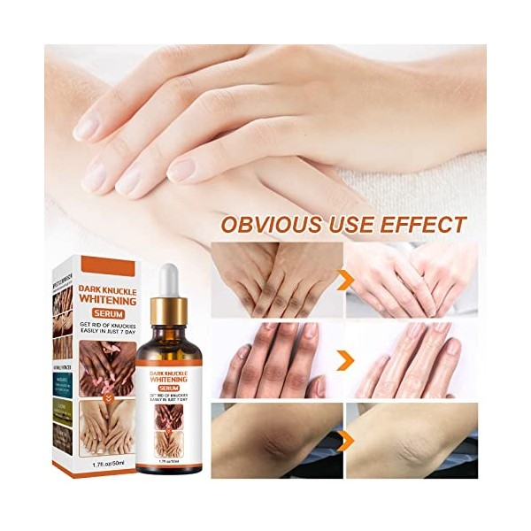 Ofanyia Correcteur de Taches Brunes Dark Knuckle Whitening Sérum Même le teint Améliorer la matité Sérum éclaircissant pour l