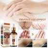 Ofanyia Correcteur de Taches Brunes Dark Knuckle Whitening Sérum Même le teint Améliorer la matité Sérum éclaircissant pour l