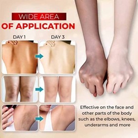 3 Days Kojic Acid Whitening Moisturizing Cream, Crème hydratante blanchissante à lacide kojique 3 jours, Crème à lacide koj