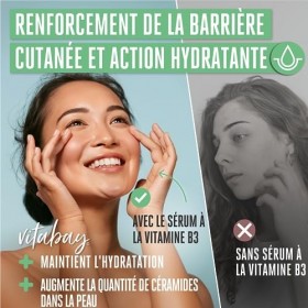 Vitabay Crème anti-âge avec 5% de niacinamide, daloe vera et dacide hyaluronique contre lacné, les rides et les taches de 