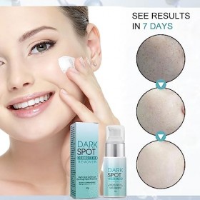 Tkekruh Crème éliminer Les Taches,Creme Visage Anti Taches,Crème Qnti-taches de Rousseur,Crème Blanchissante,Creme Anti Tache